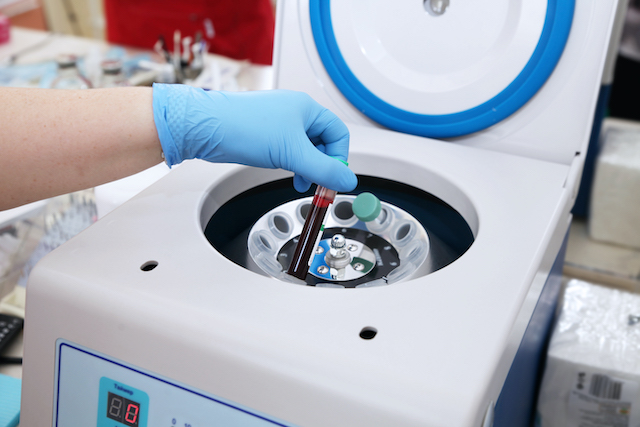 Tube of blood is placed in a medical centrifuge for plasma lifting